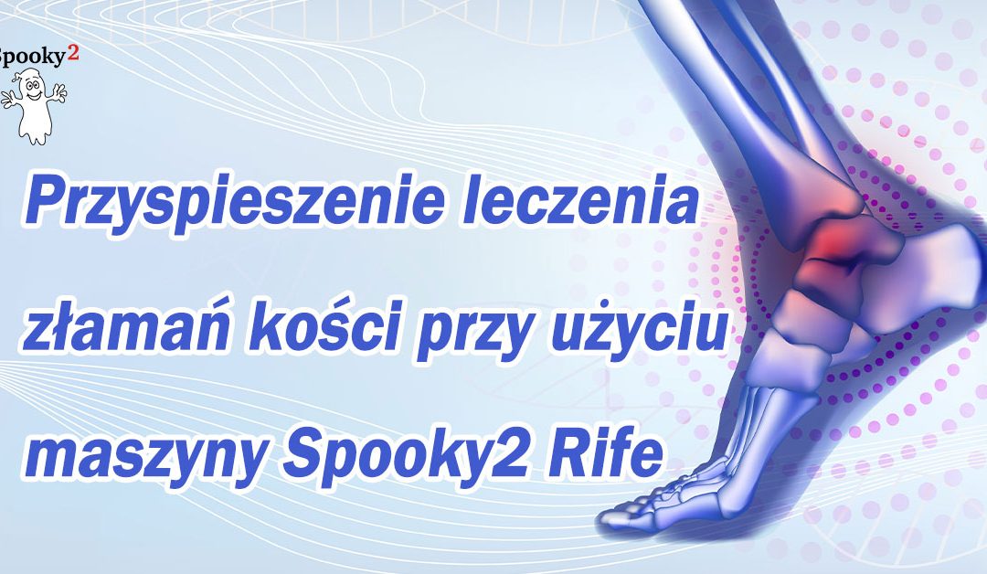 Przyspieszenie leczenia złamań kości przy użyciu maszyny Spooky2 Rife